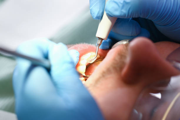 Best Emergency Cosmetic Dentistry (e.g., broken veneers) in Bull Run, VA