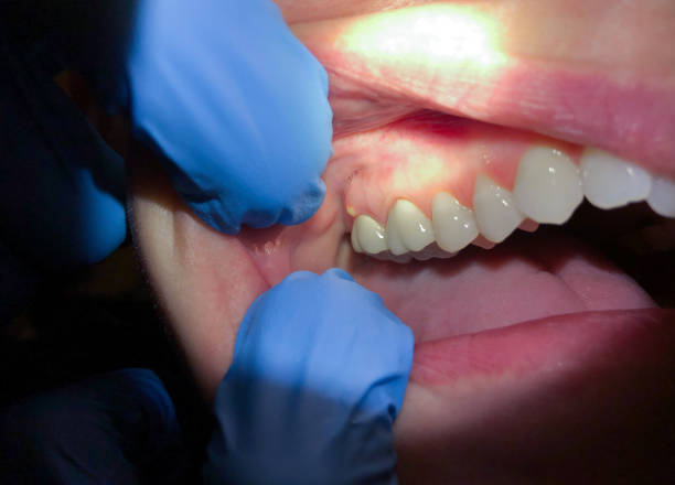 Best Emergency Denture Repair in Bull Run, VA