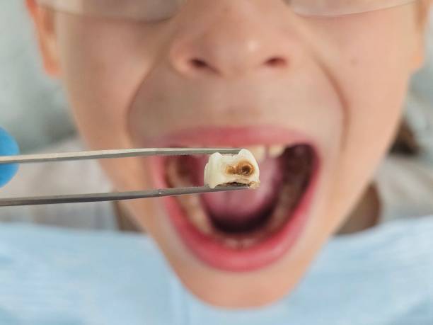 Best Emergency Pediatric Dental Care in Bull Run, VA